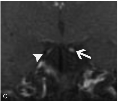 f:id:yukimukae:20210326173526p:plain