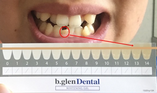 f:id:yukinosetsuna:20160802114842j:plain f:id:yukinosetsuna:20160802114842j:plain