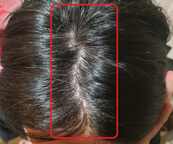 染まらないのか美容師が検証 綺和美 Root Vanish 白髪染め ヘアカラートリートメントの評価 矢沢 ゆめ Ism