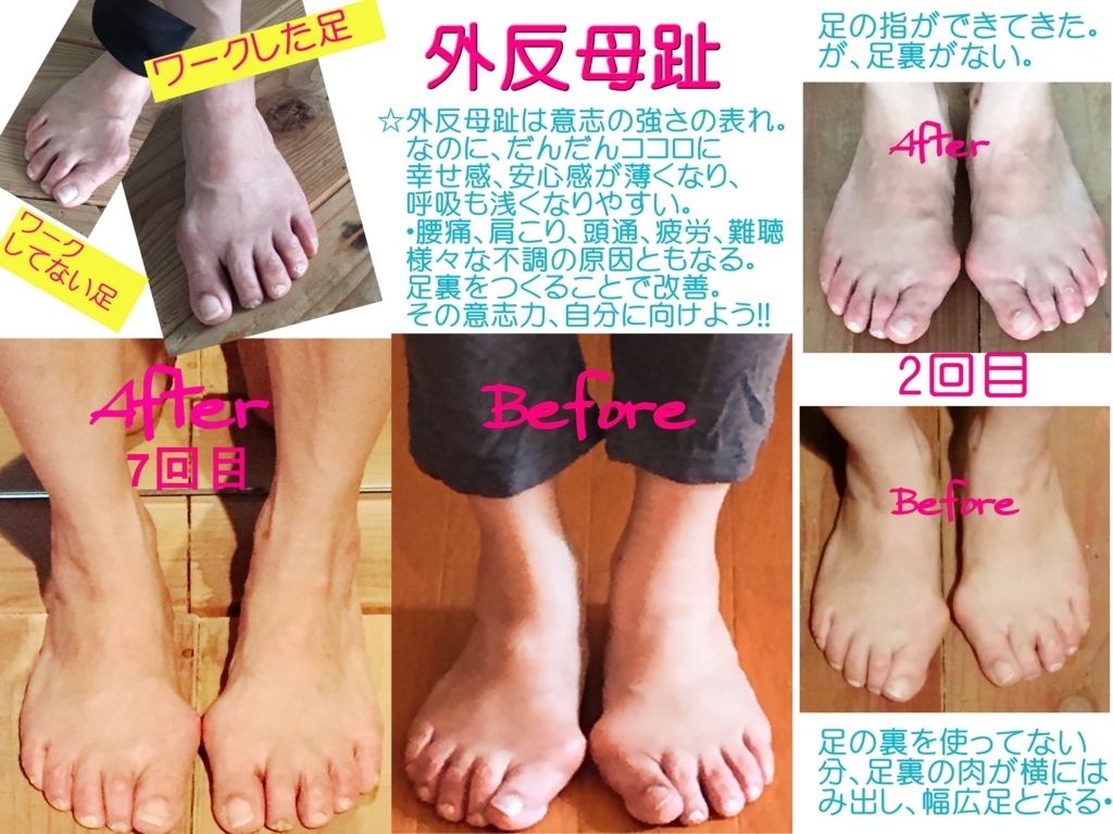 f:id:yumikomiracle:20170822232023j:plain f:id:yumikomiracle:20170822232023j:plain