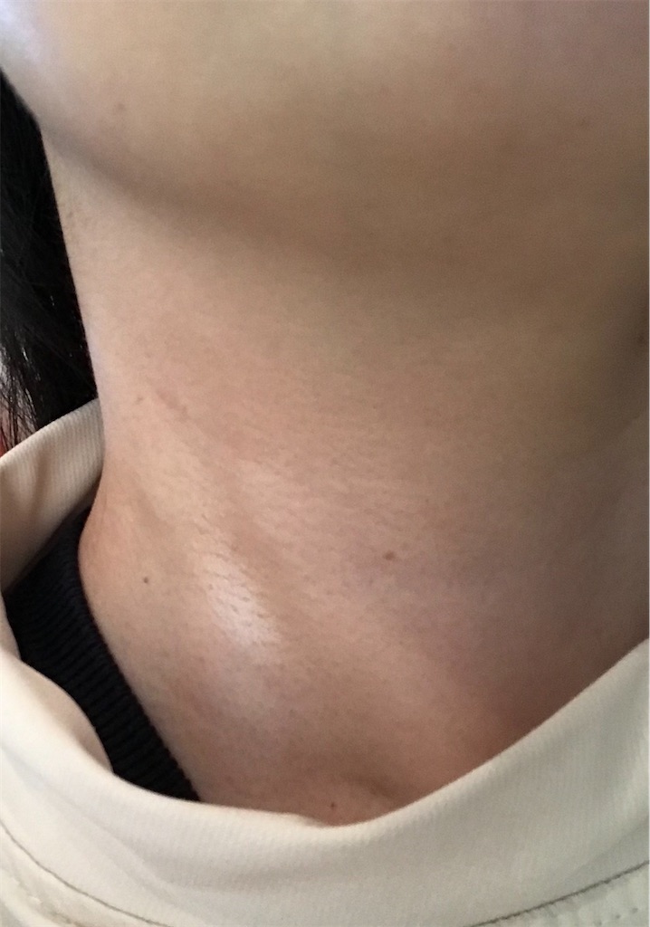 f:id:yupisu:20221208100439j:image f:id:yupisu:20221208100439j:image