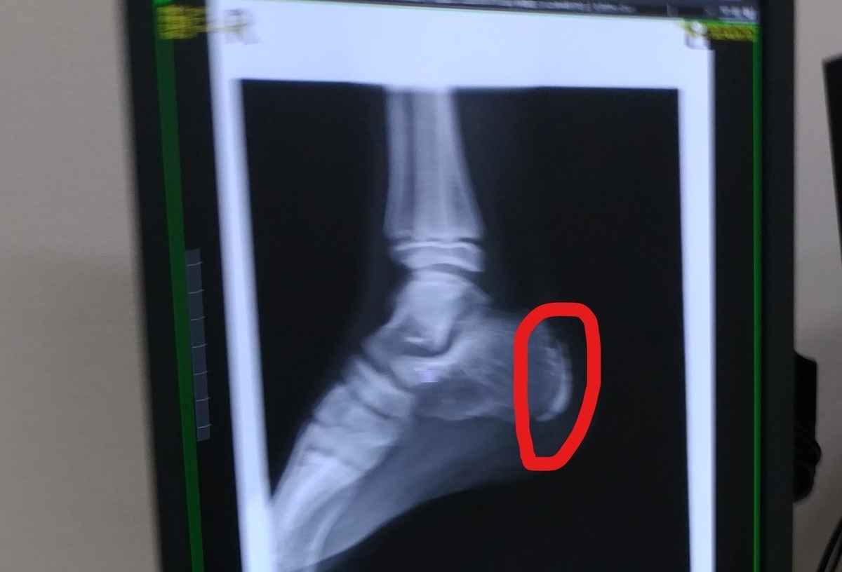 f:id:yuro0822:20210618234324j:plain