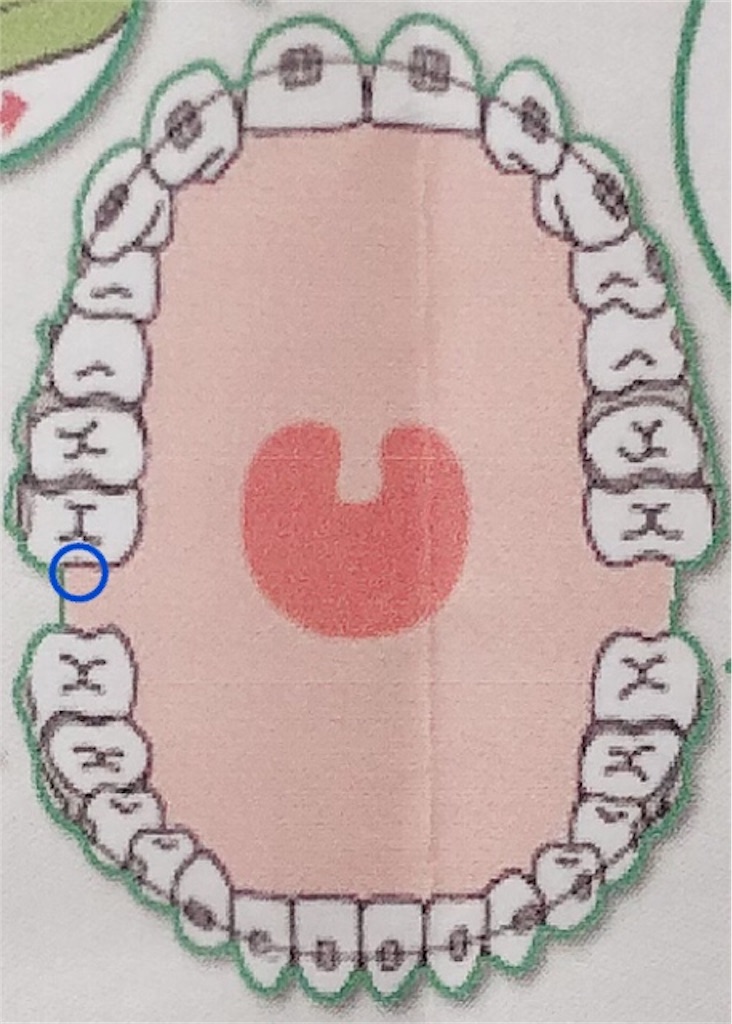 f:id:yurufuwasarachi:20190213172733j:image f:id:yurufuwasarachi:20190213172733j:image