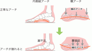 f:id:yuruyurusei:20180703223128g:plain