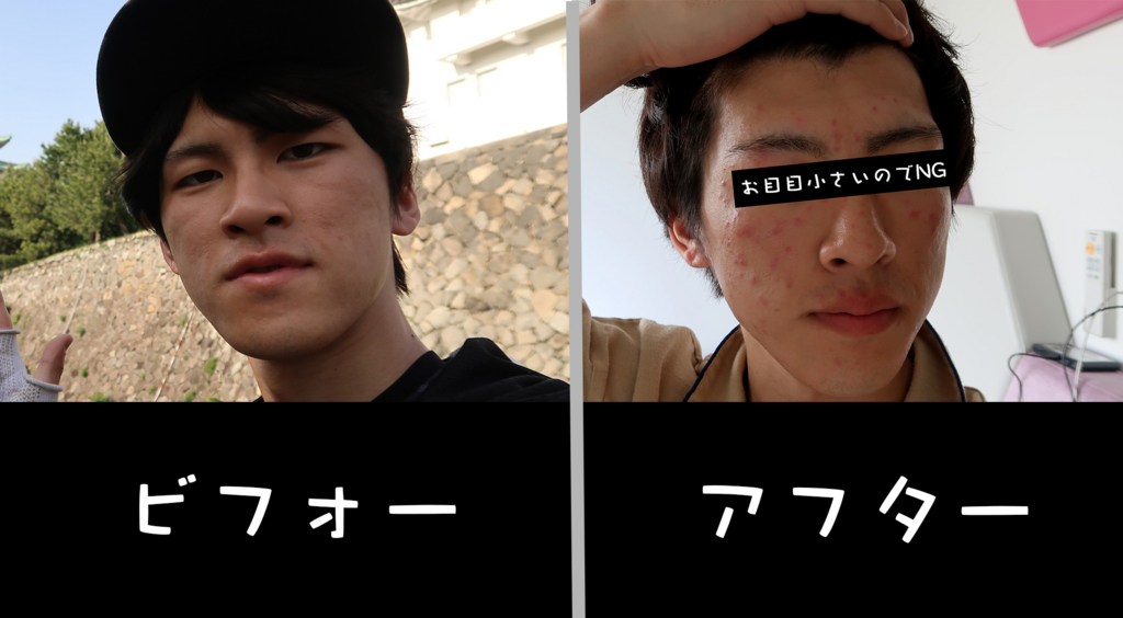 f:id:yutochiba:20180522144032j:plain f:id:yutochiba:20180522144032j:plain