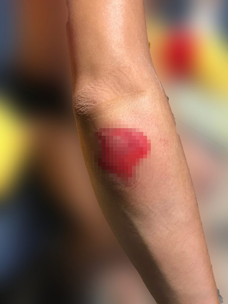 f:id:yutochiba:20180621233856j:plain f:id:yutochiba:20180621233856j:plain