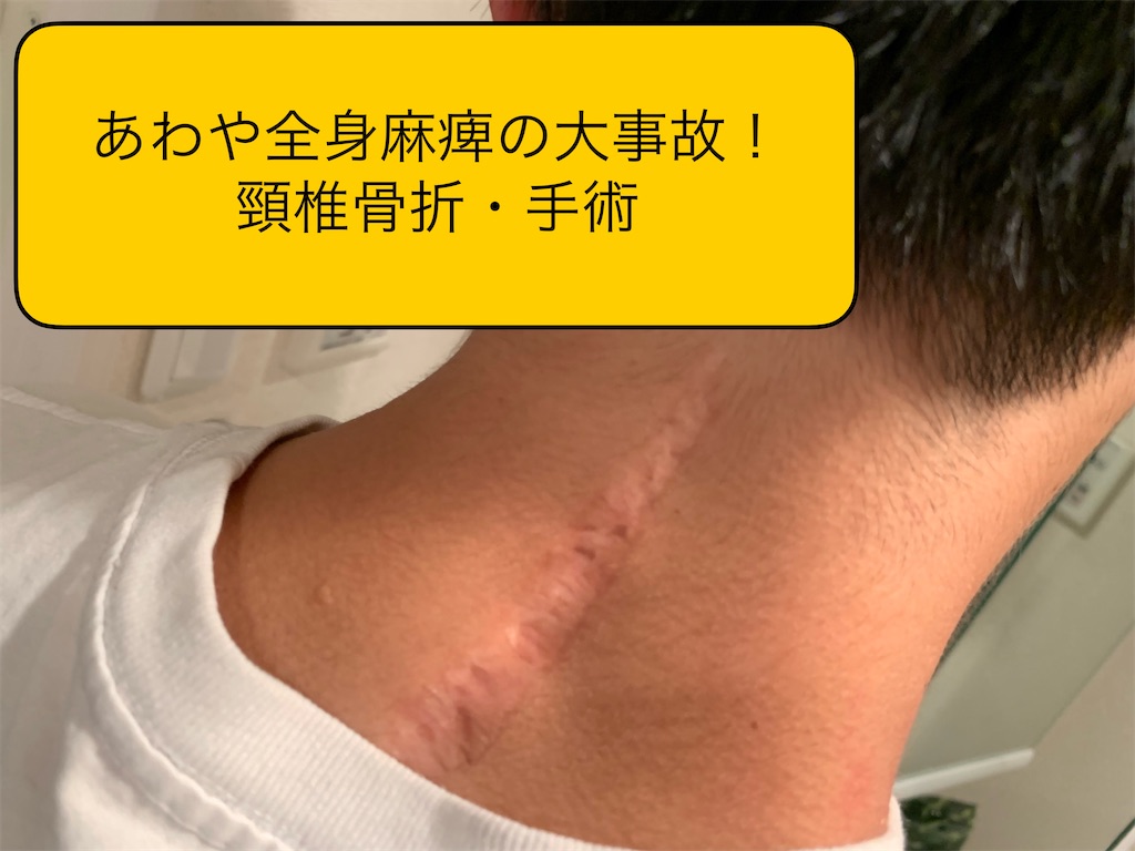 f:id:yuyamakun:20200510182943j:image f:id:yuyamakun:20200510182943j:image