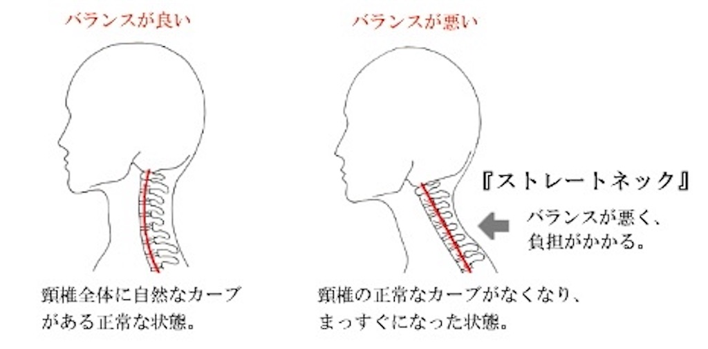 f:id:yuzudoren:20210406224021j:image f:id:yuzudoren:20210406224021j:image