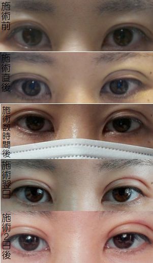 f:id:yuzuki1224:20170408122232j:plain f:id:yuzuki1224:20170408122232j:plain