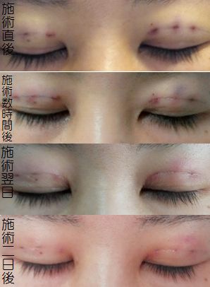 f:id:yuzuki1224:20170408122835j:plain f:id:yuzuki1224:20170408122835j:plain