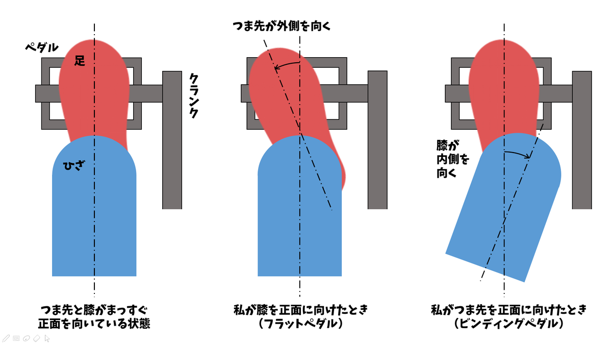 ロードバイクで帰省したら 膝痛に悩まされることになった ふんきちブログ ロードバイクで帰省したら 膝痛に悩まされることになった ふんきちブログ
