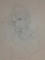ガラは右目から体を覆う蔦が伸びてくる病気です#奇病にかかったー