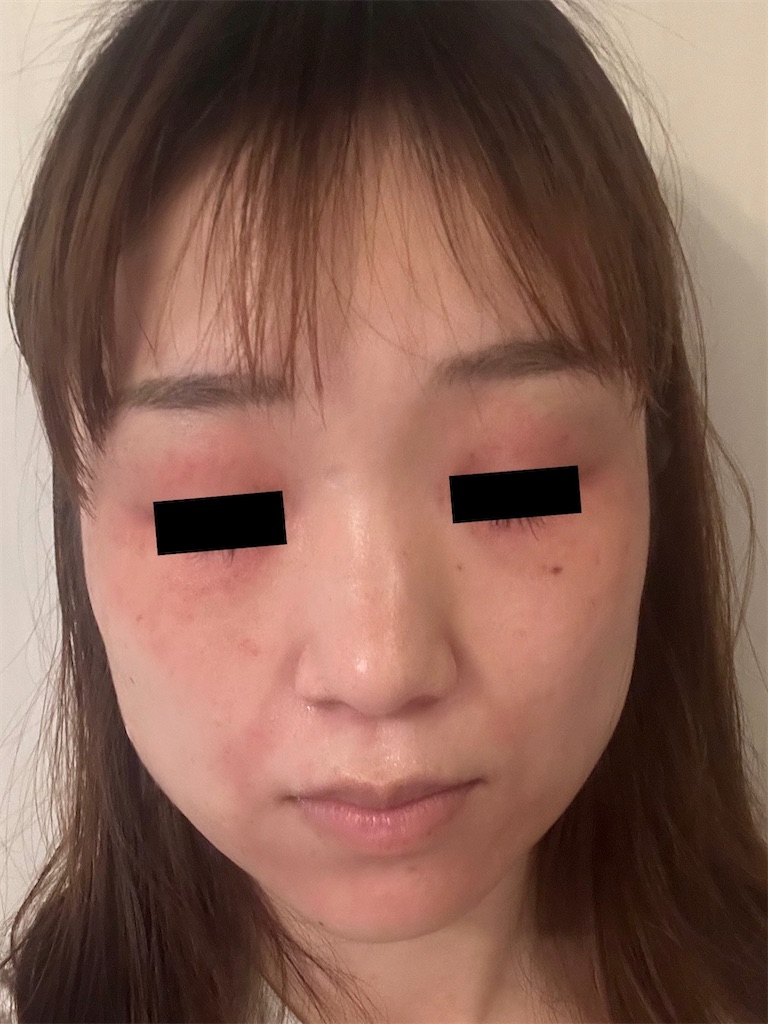 f:id:zenyori:20240603223614j:image f:id:zenyori:20240603223614j:image