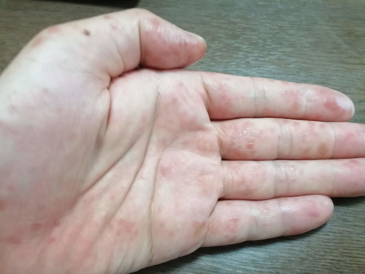 f:id:zhizuchangle:20190728064318j:plain f:id:zhizuchangle:20190728064318j:plain