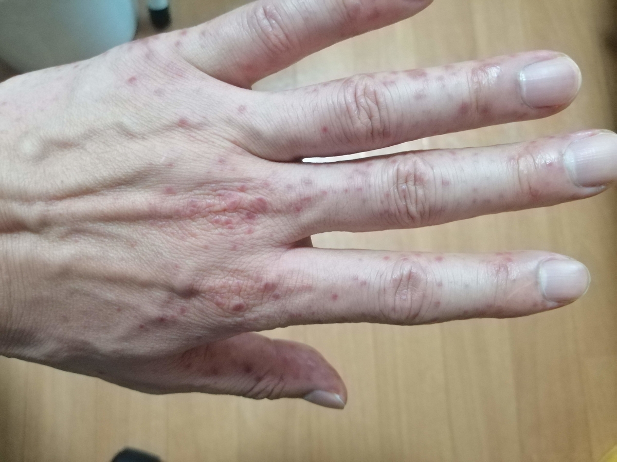 f:id:zhizuchangle:20190728064329j:plain f:id:zhizuchangle:20190728064329j:plain
