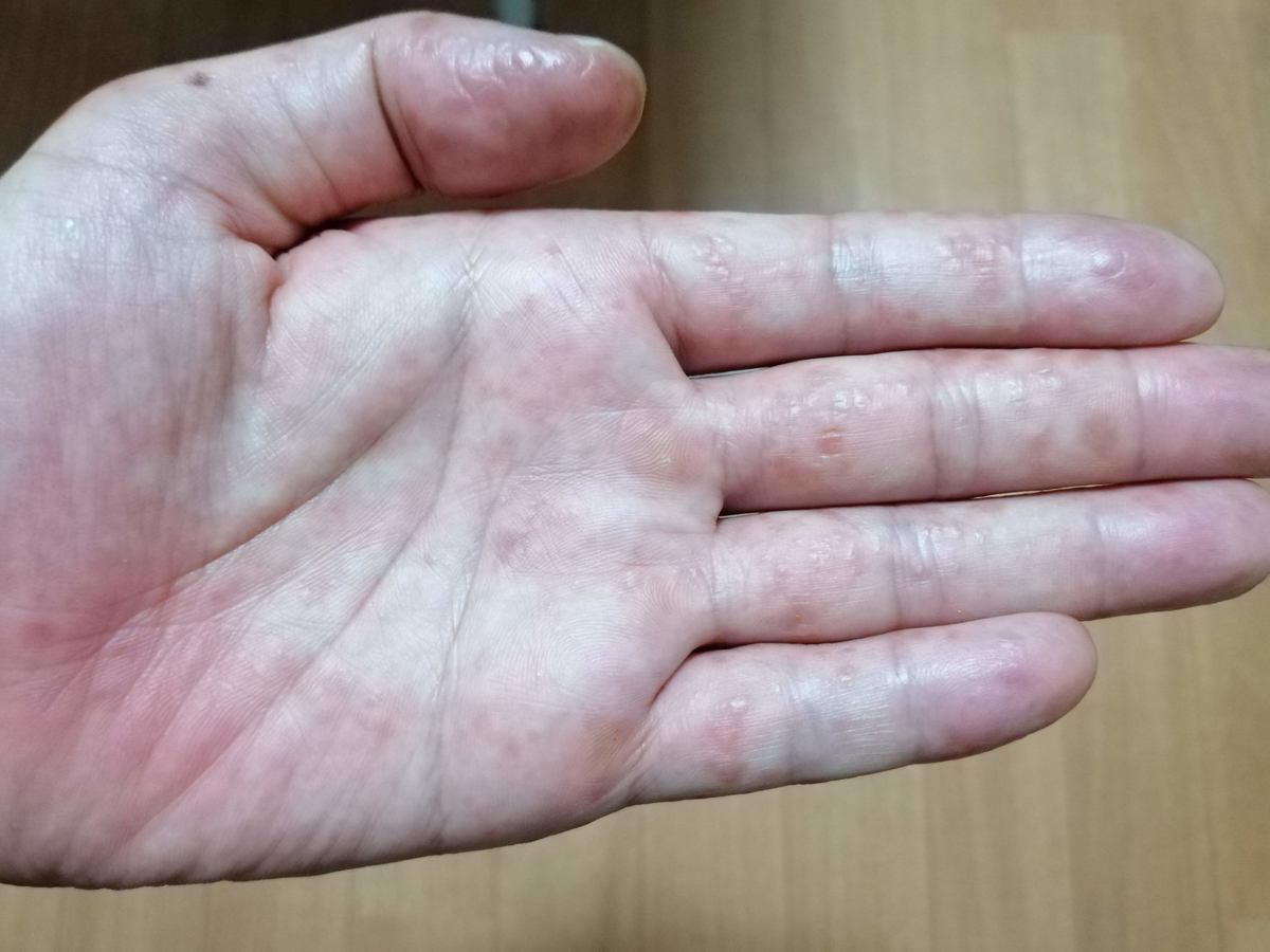 f:id:zhizuchangle:20190728064435j:plain f:id:zhizuchangle:20190728064435j:plain