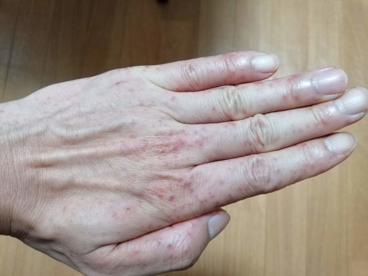 f:id:zhizuchangle:20190728064444j:plain f:id:zhizuchangle:20190728064444j:plain