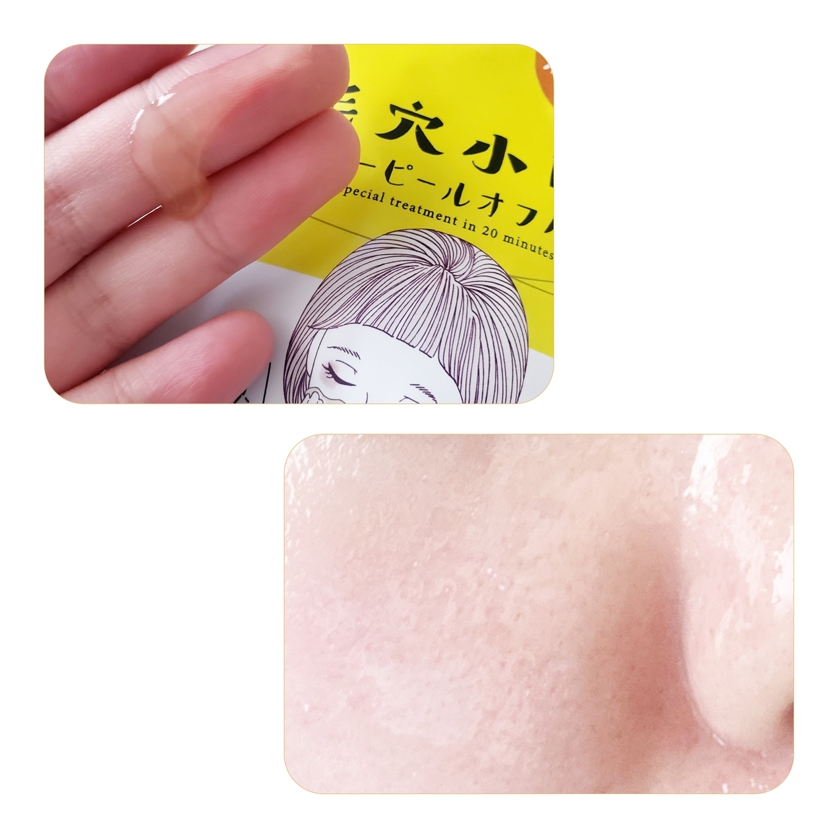 毛穴小町のイエローピールオフパックを口コミレビュー！【使用頻度