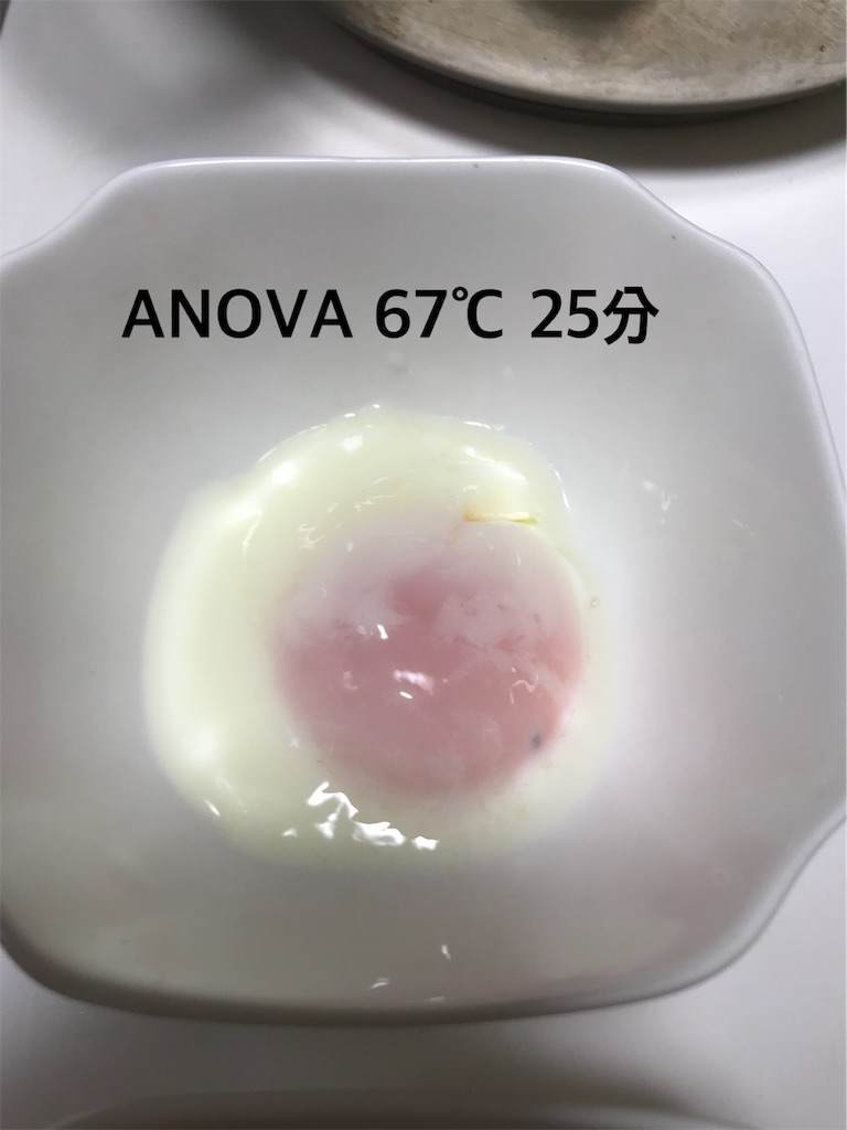 f:id:zubora_mom:20181209081304j:plain f:id:zubora_mom:20181209081304j:plain