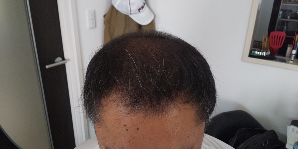 f:id:zzz2200:20190625183449j:plain f:id:zzz2200:20190625183449j:plain